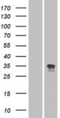 Novus Biologicals&trade;&nbsp;OR52N2 Overexpression Lysate