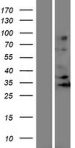 Novus Biologicals&trade;&nbsp;OR5J2 Overexpression Lysate