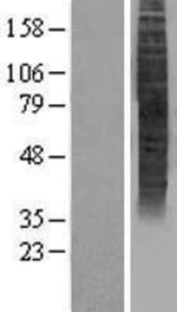 Novus Biologicals&trade;&nbsp;OR5P3 Overexpression Lysate