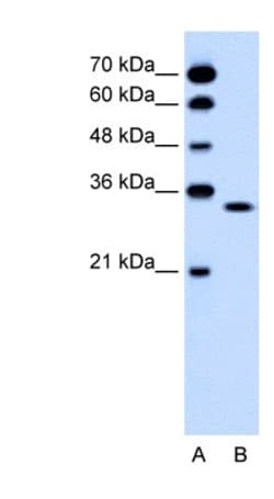 OR5T2 Antibody, Novus Biologicals:Antibodies:Primary Antibodies