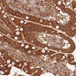 OR5V1 Antibody, Novus Biologicals:Antibodies:Primary Antibodies