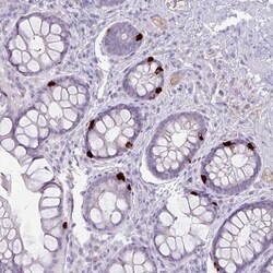 OR6C6 Antibody, Novus Biologicals 0.1mL; Unlabeled:Antibodies, Polyclonal