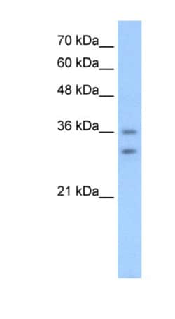 OR6C70 Antibody, Novus Biologicals 100&mu;L; Unlabeled:Antibodies, Polyclonal
