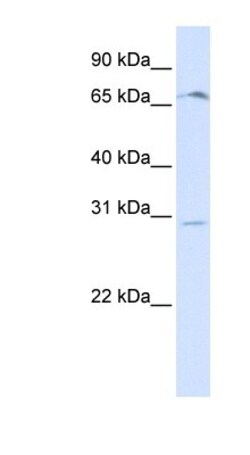 OR6C75 Antibody, Novus Biologicals 100&mu;L; Unlabeled:Antibodies, Polyclonal