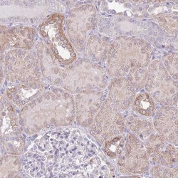 OR6M1 Antibody, Novus Biologicals:Antibodies:Primary Antibodies