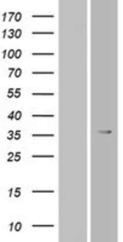 Novus Biologicals&trade;&nbsp;OR6T1 Overexpression Lysate