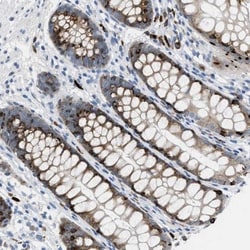OR9K2 Antibody, Novus Biologicals 25 &mu;L, Unlabeled:Antibodies, Polyclonal