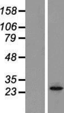 Novus Biologicals&trade;&nbsp;Orai2 Overexpression Lysate