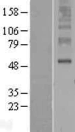 Novus Biologicals™ ORAI3 Overexpression Lysate