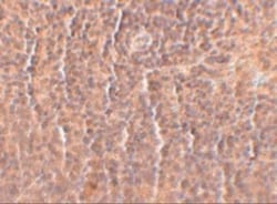 ORAI3 Antibody (2H2G9) - BSA Free, Novus Biologicals 0.1mg; Unlabeled:Antibodies,