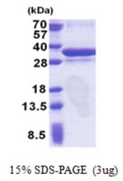Novus Biologicals&trade;&nbsp;Recombinant Human ORC6L His Protein