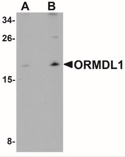 ORMDL1 Antibody - BSA Free, Novus Biologicals 0.1mg; Unlabeled:Antibodies,