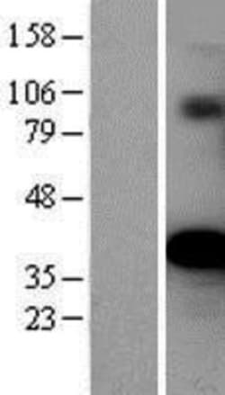 Novus Biologicals™ Ornithine Carbamoyltransferase Overexpression Lysate