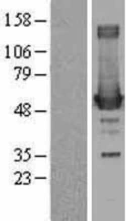 Novus Biologicals™ Ornithine Decarboxylase Overexpression Lysate