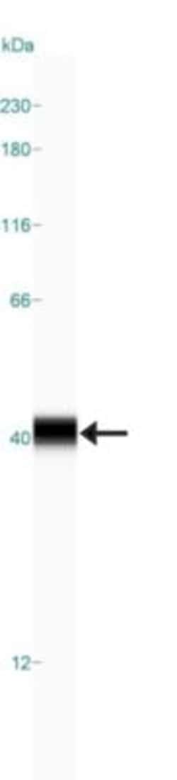 Ornithine Carbamoyltransferase Antibody, Novus Biologicals 0.1mL; Unlabeled:Antibodies,