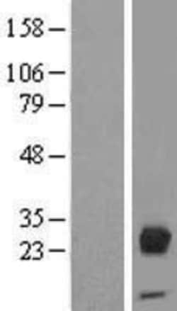 Novus Biologicals&trade;&nbsp;Orosomucoid 2 Overexpression Lysate