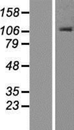 Novus Biologicals&trade;&nbsp;ORP1 Overexpression Lysate