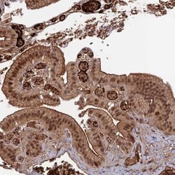 ORP1 Antibody, Novus Biologicals 0.1mL; Unlabeled:Antibodies, Polyclonal