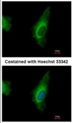 ORP8 Antibody, Novus Biologicals 0.1mL; Unlabeled:Antibodies, Polyclonal