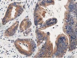 OSBP1 Antibody (OTI1F2), Novus Biologicals 0.1mL; Unlabeled:Antibodies,