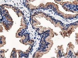 OSBP1 Antibody (OTI1F2), Novus Biologicals 0.1mL; Unlabeled:Antibodies,