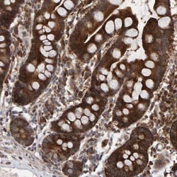 OSBP2 Antibody, Novus Biologicals 0.1mL; Unlabeled:Antibodies, Polyclonal