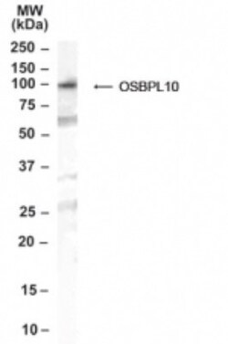 OSBPL10 Antibody, Novus Biologicals 0.1mg; Unlabeled:Antibodies, Polyclonal
