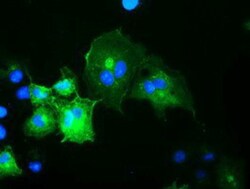 OSBPL11 Antibody (OTI6A6), Novus Biologicals 0.1mL; Unlabeled:Antibodies,