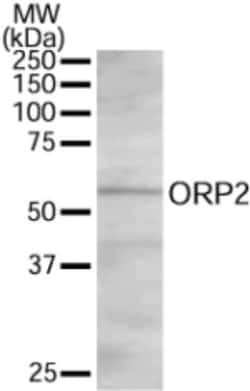 OSBPL2 Antibody, Novus Biologicals 0.1 mg | Buy Online | Novus Biologicals | Fisher Scientific