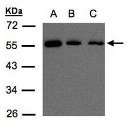 OSBPL2 Antibody, Novus Biologicals 0.1mg; Unlabeled:Antibodies, Polyclonal