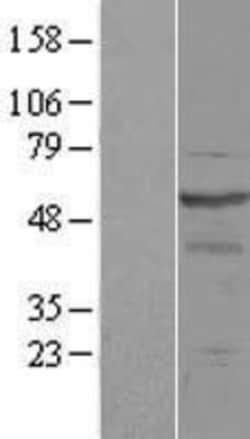 Novus Biologicals&trade;&nbsp;OSBPL2 Overexpression Lysate