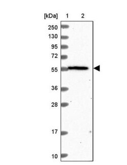 OSBPL2 Antibody, Novus Biologicals 0.1mL; Unlabeled:Antibodies, Polyclonal