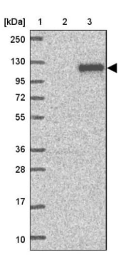 OSBPL5 Antibody, Novus Biologicals 25 &mu;L, Unlabeled:Antibodies, Polyclonal