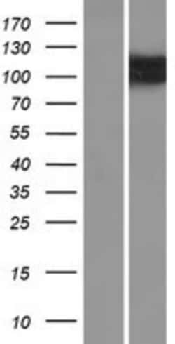 Novus Biologicals™ OSBPL5 Overexpression Lysate