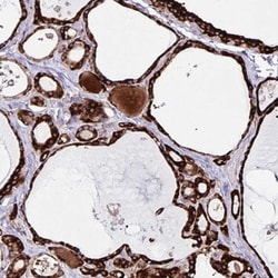 OSBPL5 Antibody, Novus Biologicals 25 &mu;L, Unlabeled:Antibodies, Polyclonal
