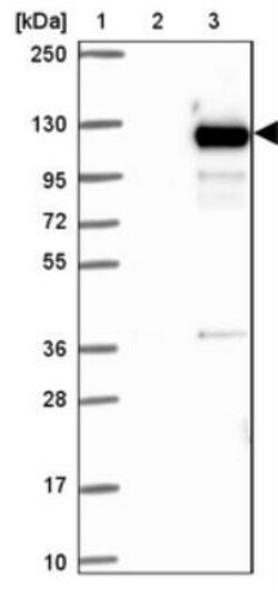 OSBPL5 Antibody, Novus Biologicals 0.1mL; Unlabeled:Antibodies, Polyclonal