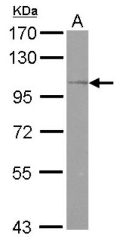 OSBPL5 Antibody, Novus Biologicals 0.1mL; Unlabeled:Antibodies, Polyclonal