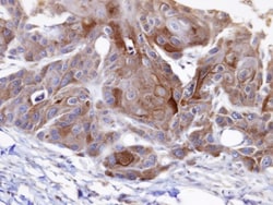 OSBPL6 Antibody, Novus Biologicals 0.1mg; Unlabeled:Antibodies, Polyclonal