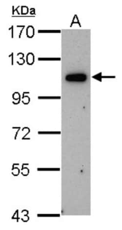 OSBPL6 Antibody, Novus Biologicals 0.1mg; Unlabeled:Antibodies, Polyclonal