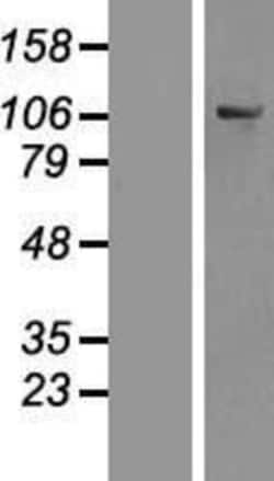 Novus Biologicals™ OSBPL6 Overexpression Lysate