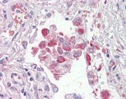 OSBPL9 Antibody, Novus Biologicals 0.1mg; Unlabeled:Antibodies, Polyclonal