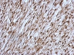 OSBPL9 Antibody, Novus Biologicals 0.1mL; Unlabeled:Antibodies, Polyclonal