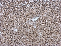 OSBPL9 Antibody, Novus Biologicals 0.1mL; Unlabeled:Antibodies, Polyclonal