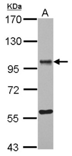 OSBPL9 Antibody, Novus Biologicals 0.1mL; Unlabeled:Antibodies, Polyclonal