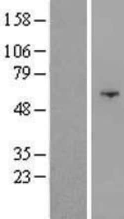 Novus Biologicals&trade;&nbsp;OSBPL9 Overexpression Lysate