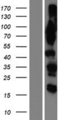 Novus Biologicals™ OSBPL9 Overexpression Lysate