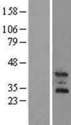 Novus Biologicals&trade;&nbsp;OSCAR Overexpression Lysate