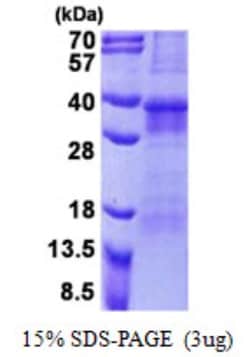 Novus Biologicals&trade;&nbsp;Recombinant Human OSCAR His Protein