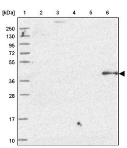 OSGEP Antibody, Novus Biologicals 0.1 mL | Buy Online | Novus Biologicals | Fisher Scientific