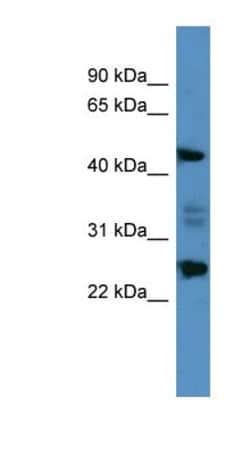 OSGIN2 Antibody, Novus Biologicals 100μL; Unlabeled:Antibodies, Polyclonal